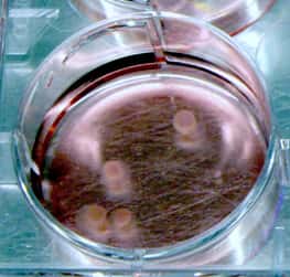 Quatre « mini-cerveaux » dans leur boîte de Petri. Leur petite taille permet de nourrir les cellules par un milieu liquide approprié bien qu'il n'y ait aucune vascularisation. © CellTechs