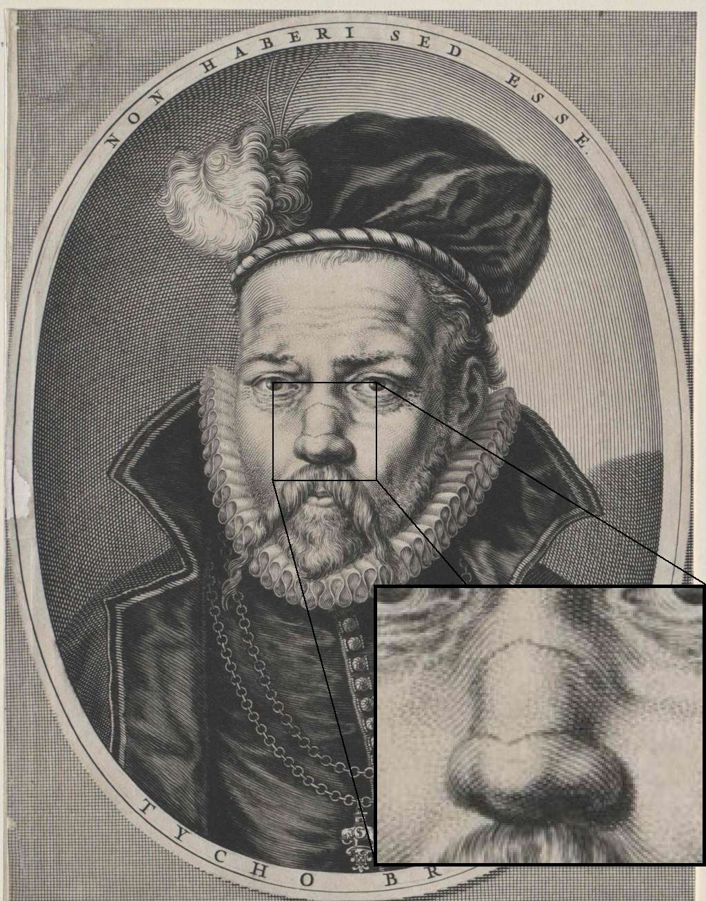 Sur le portrait de Tycho Brahe, on constate clairement que seule l'arête du nez est entamée. © Joseph Louis François Bertrand, Domaine public, <em>Wikimedia Commons</em>