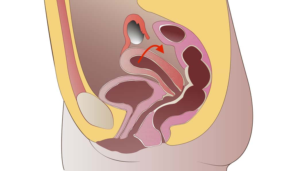 Dans 75 % à 80 % des cas, l’utérus (au milieu) est positionné vers l’avant, reposant sur la vessie. Quand l’utérus est rétroversé, il est dirigé à l’arrière ver le rectum. © C.D, dianacreativa, Fotolia