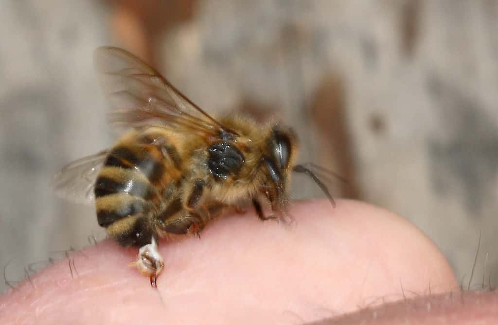 Après avoir piqué, une abeille abandonne dans notre peau, non seulement son dard, mais aussi sa glande à venin. © Waugsgerb, Wikipédia, CC by-sa 3.0