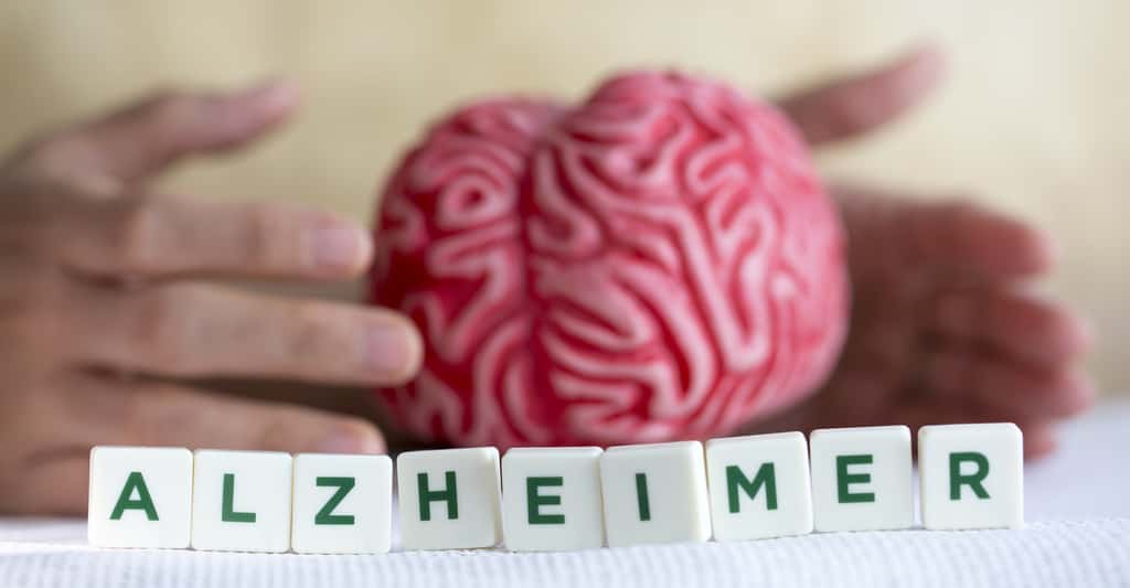La maladie d’Alzheimer atteint le cerveau. Mais des chercheurs assurent aujourd’hui qu’elle laisse aussi des traces dans nos yeux. © aytuncoylum, Fotolia
