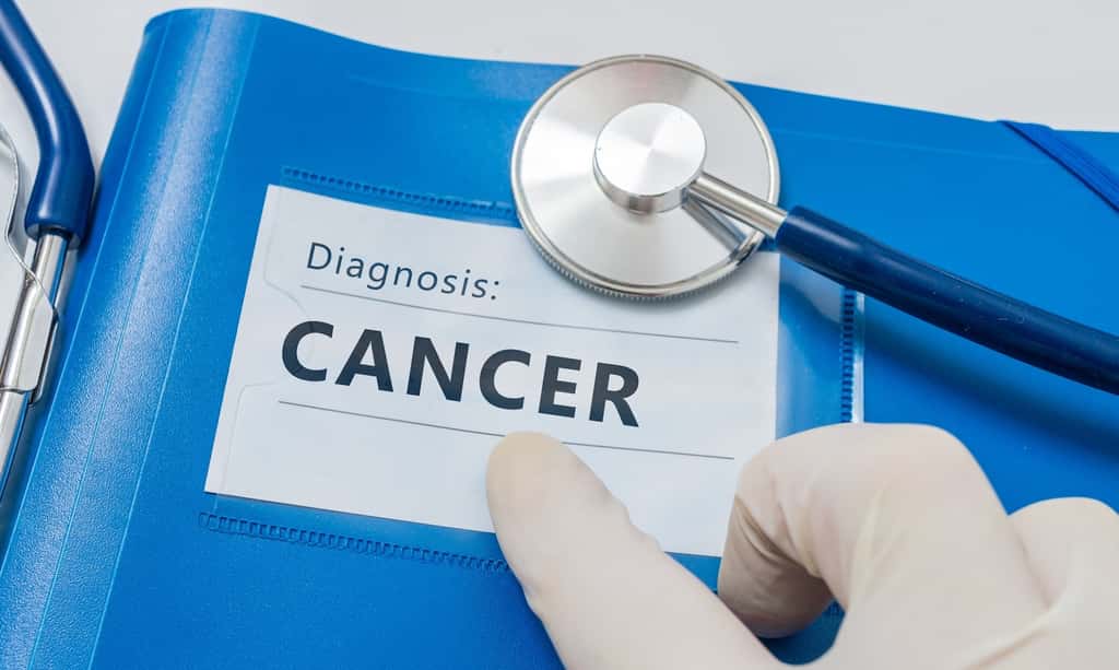 Les termes cancérologie et oncologie désignent la même spécialité médicale, celle qui traite des lésions cancéreuses. Le premier nous vient simplement du latin et le second, du grec. © vchalup, Fotolia