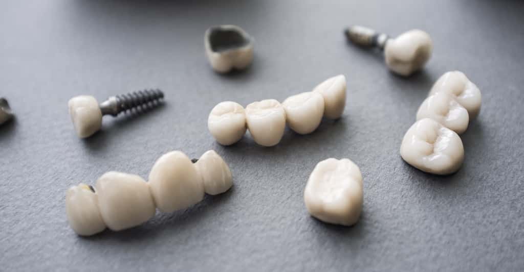 Certaines couronnes dentaires sont faites de céramique. © golubovy, Fotolia