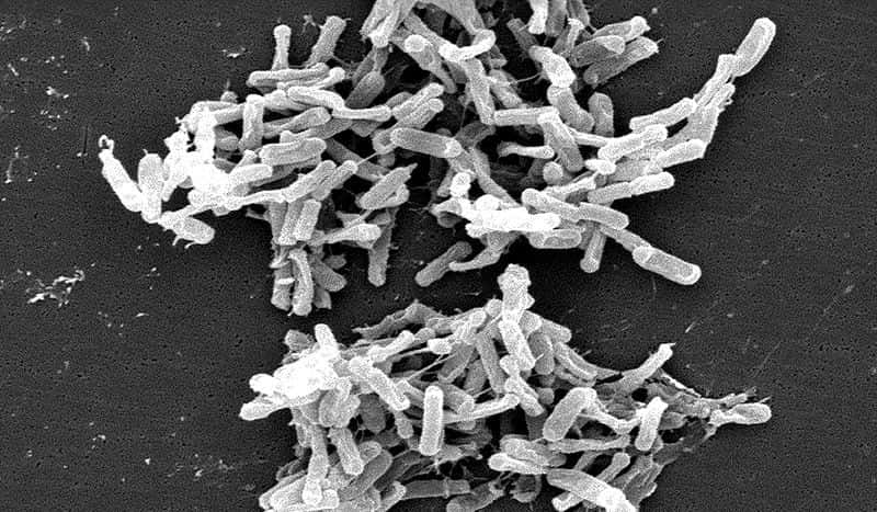 Le genre des <em>Clostridi</em> regroupe plusieurs espèces bactériennes anaérobies et souvent sporulées. Certaines sont pathogènes pour l’Homme comme <em>Clostridium botulinum</em> ou <em>Clostridium difficile</em>. Mais de nombreuses espèces au contraire bienfaitrices sont présentent dans l’intestin humain et dans le lait maternel. © Wikimedia Commons, CDC, DP