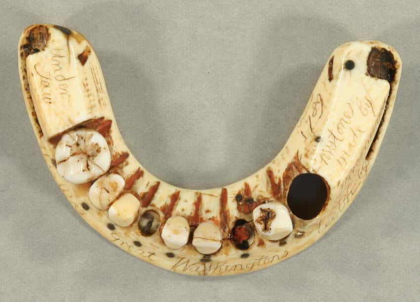Ce dentier produit par Greenwood pour George Washington s'insère sur l'unique dent restante, au niveau de la mâchoire inférieure. © Mount Vernon