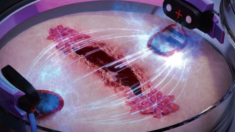 De nouvelles recherches montrent que les plaies sur des cellules cutanées cultivées guérissent trois fois plus vite lorsqu'elles sont stimulées par un courant électrique. © Hassan A. Tahini, <em>Science Brush</em>