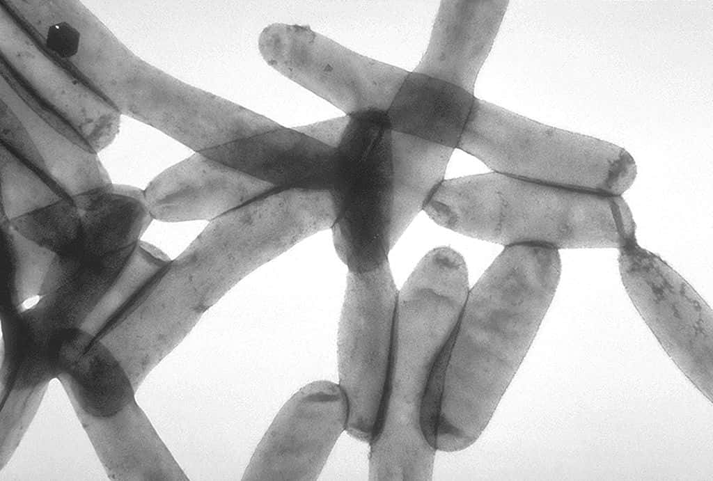 La légionellose au microscope. © <em>CDC Public Health Image Library</em>