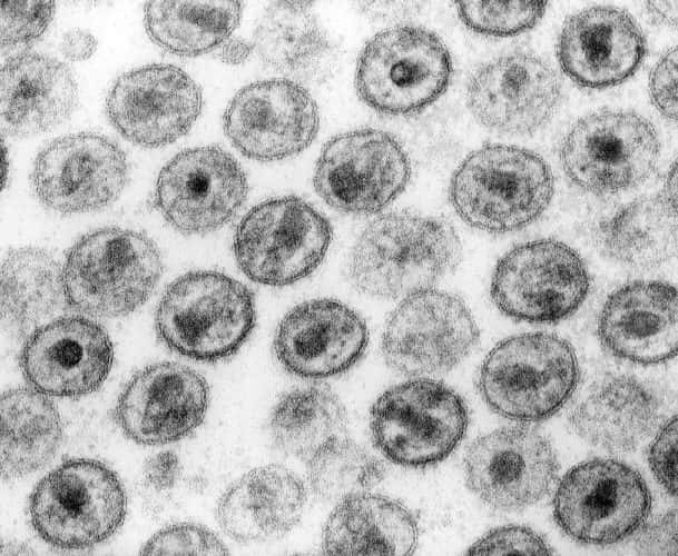 Le VIH-1 au microscope électronique. La protéine Nef est conservée parmi les lentivirus. © CDC, Dr. Edwin P. Ewing, Jr., Wikimedia Commons, domaine public