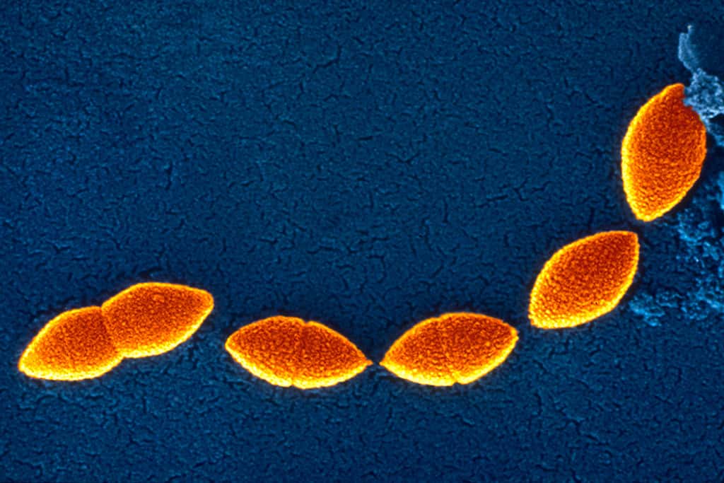 La bactérie<em> Streptococcus pneumoniae</em> peut être responsable d’une méningite bactérienne : la méningite à pneumocoque. Elle cause aussi des pneumonies bactériennes, otites, sinusites, bronchites. © Alain Grillet,Sanofi Pasteur, CC by-nc-nd 2.0