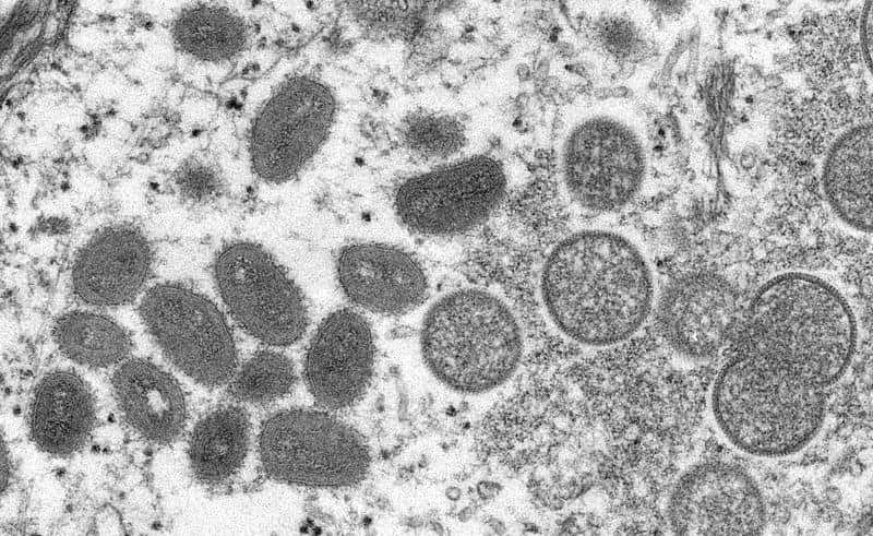Le virus de la variole du singe (formes ovoïdes foncées) observé au microscope électronique isolé d'un échantillon humain. © Cynthia S. Goldsmith, Russell Regnery, CDC