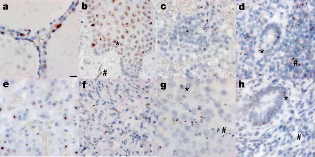 L'ARN du coronavirus détecté dans : a/ l'œsophage ; b/ la rate ; c/ l'appendice ; d/ une glande surrénale ; e/ l'ovaire ; f/ le testicule ; g/ l'endomètre et h/ un tissu extra-pulmonaire de patients décédés de la Covid-19. © Sydney R. Stein et <em>al.</em>, <em>Nature</em> 2022