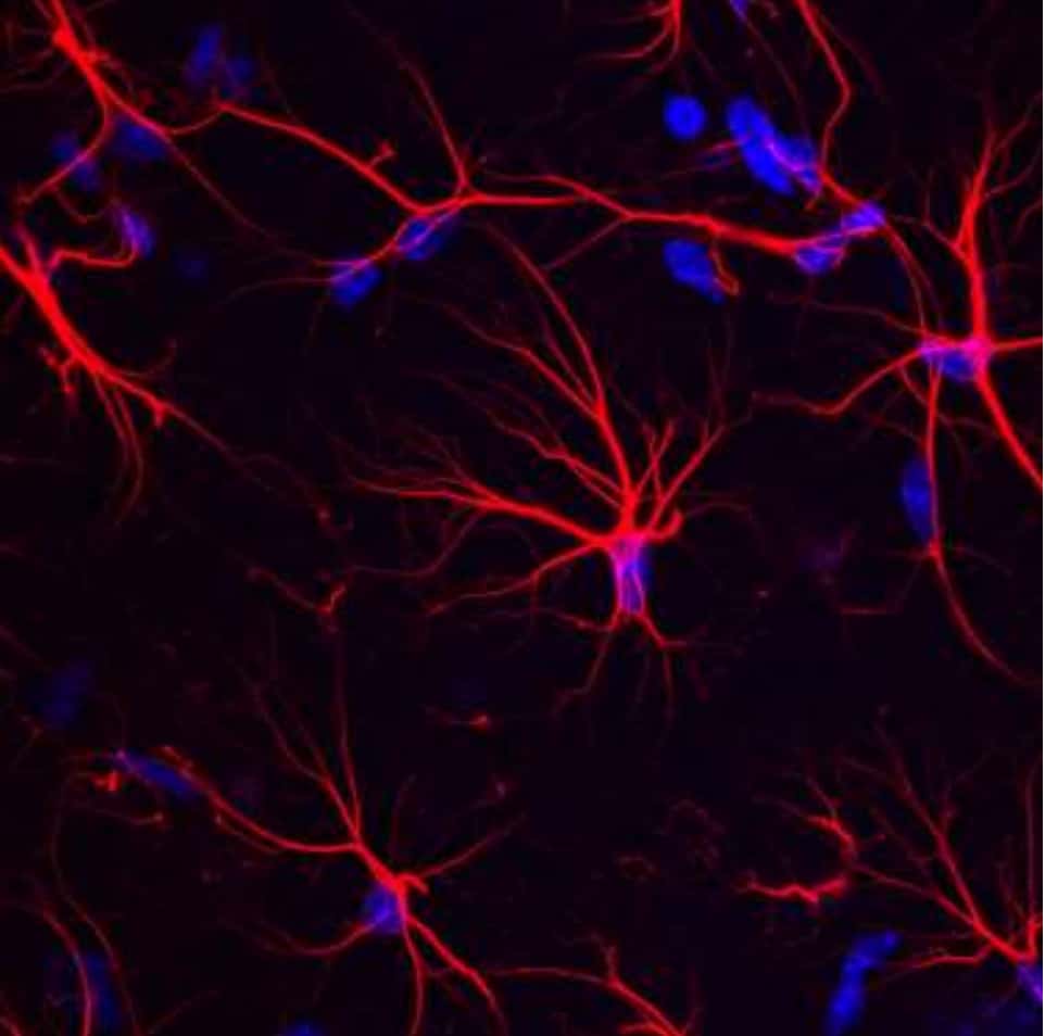 Astrocytes dans l'hippocampe du cerveau de la souris. © Laboratoire des maladies neurodégénératives (CNRS/CEA/Université Paris Saclay)