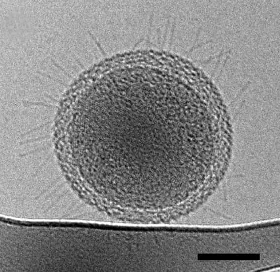 À la surface de ces bactéries minuscules, des appendices ressemblant à des pili pourraient permettre des connexions avec d’autres micro-organismes. La barre représente 100 nanomètres. © <em>Berkeley Lab</em>