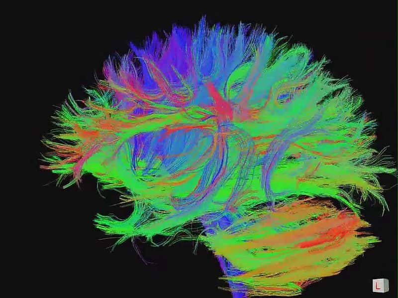 Connexions entre neurones du cerveau. La synchronisation des ondes cérébrales pourrait précéder la formation de nouvelles synapses. © jgmarcelino (<em>Newcastle upon Tyne</em>, Royaume-Uni), cc by 2.0