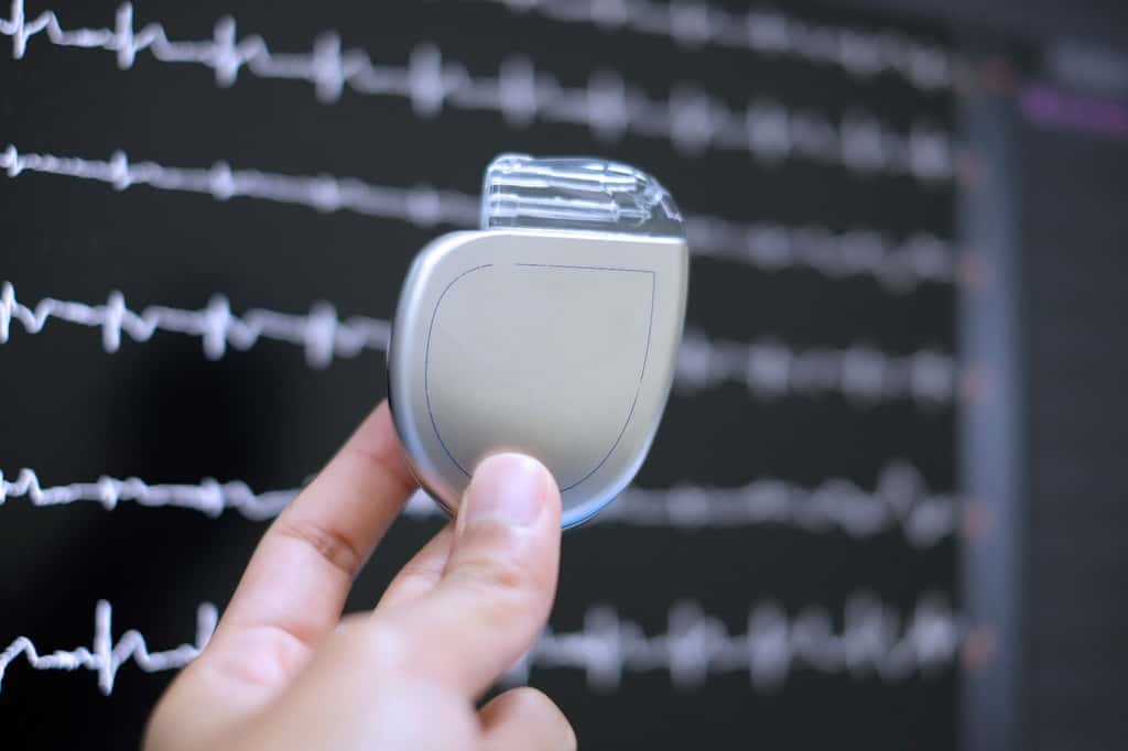 Un exemple de DAI. Il est implanté sous la peau du patient à proximité du cœur. © Pijitra, Adobe Stock