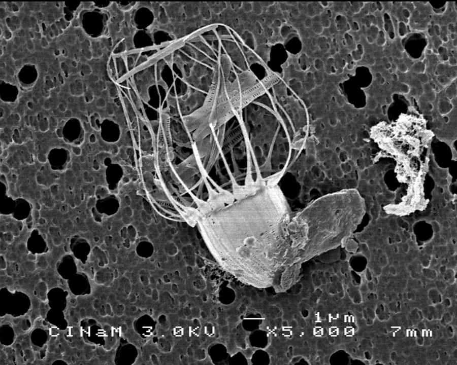 Un choanoflagellé, prédateur de cellules phytoplanctoniques, vu en microscopie électronique à balayage au Centre interdisciplinaire de nanoscience de Marseille (CINaM). © Serge Nietsche
