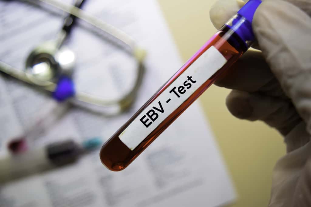 90 % de la population mondiale est infectée par le virus d'Epstein-Barr (EBV). © syahrir, Adobe Stock
