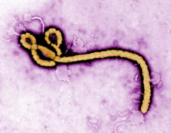 Le virus Ebola est un filovirus (de forme filamenteuse) et dont le génome est constitué d'ARN. Très contagieux, il provoque chez les primates des fièvres, des hémorragies et une immunodépression (c'est la maladie à virus Ebola, auparavant appelée fièvre hémorragique), avec un taux de létalité élevé. © CDC, Frederick A. Murphy
