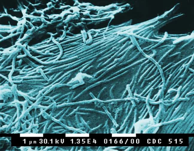 Cette image de microscopie électronique montre des virions d’Ébola. © Public Library of Science, Plos Biology 2005