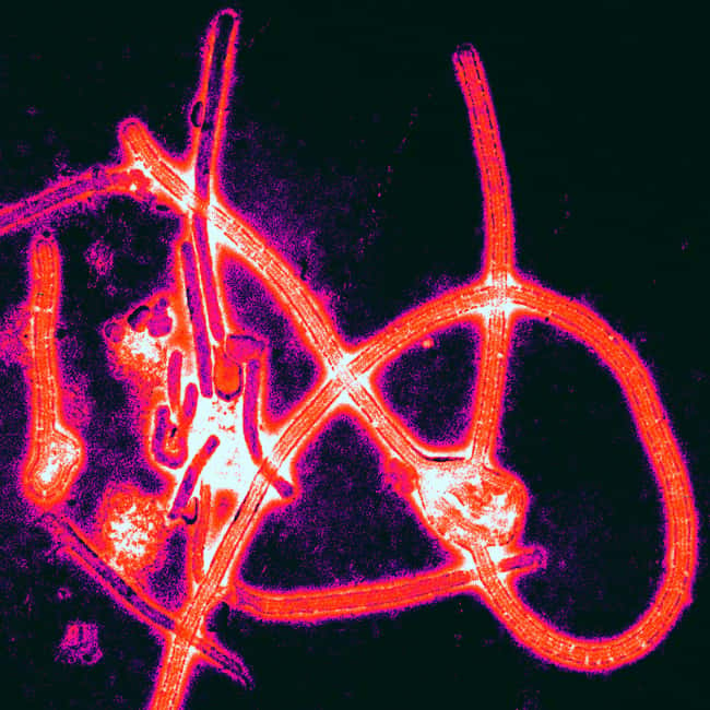 Des particules de virus Ébola, responsable de l'épidémie de fièvre hémorragique. © Thomas W. Geisbert, Boston University School of Medicine, PLOS Pathogens 2008, cc by 2.5