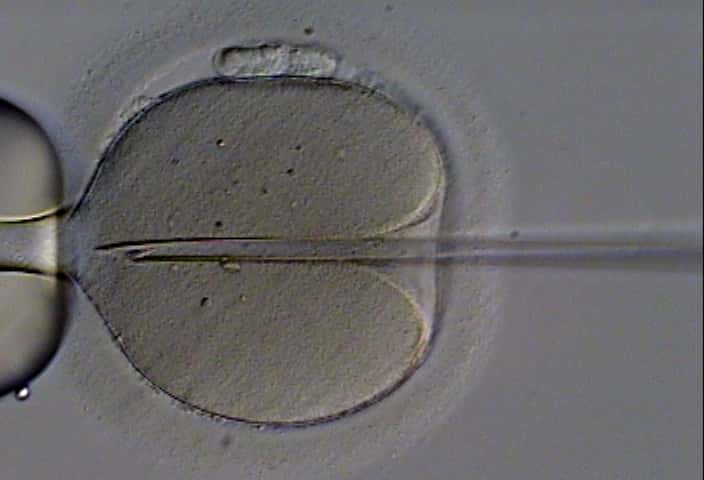 L’ICSI (injection intra-cytoplasmique de spermatozoïde) peut apporter une solution lorsque la qualité du sperme est en cause. © Eugene Ermolovich (CRMI), Wikimedia Commons, cc by sa 3.0