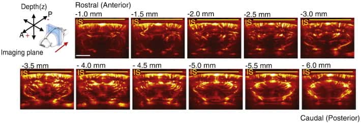 Visualisation de la vascularisation d'un cerveau de rat, sur différents plans, après injection de microbulles par imagerie doppler ultrasensible. Recherche à paraître dans <em>NeuroImage</em> en janvier 2016. © Errico <em>et al.</em> 2016, <em>NeuroImage</em>