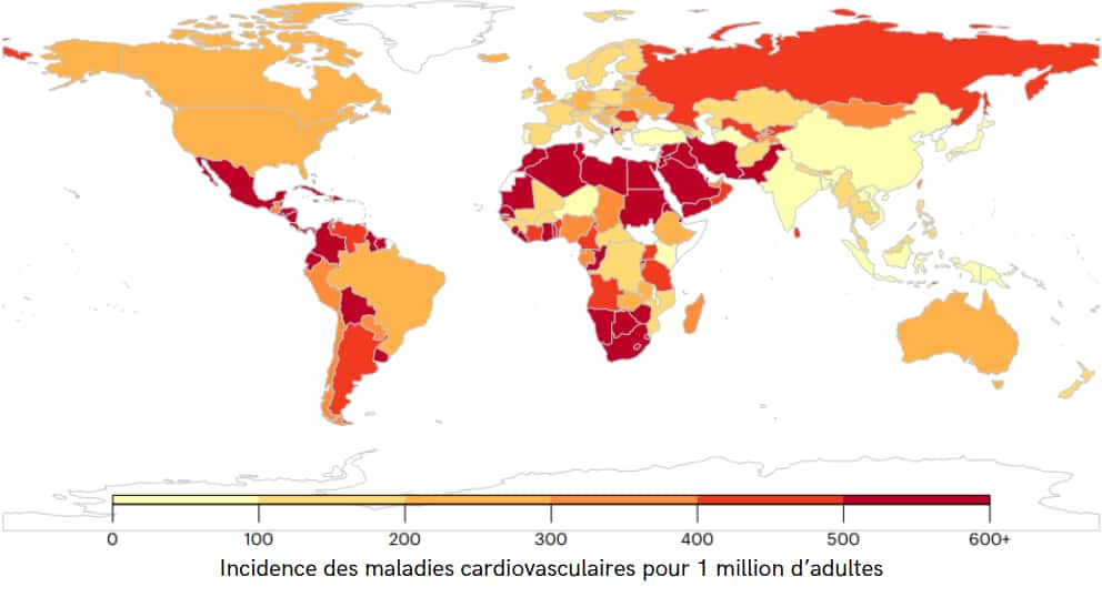 Incidence des maladies cardiovasculaires pour 1 million d'adultes attribuable à la consommation de boissons sucrées chez les adultes dans 184 pays en 2020.© <em>Tufts University</em>