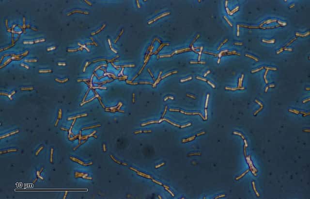 Des bactéries probiotiques, comme _Lactobacillus acidophilus_, ont servi à un test pour quantifier le nombre de bactéries transférées dans un baiser. © Josef Reischig, <em>Wikimedia Commons</em>, cc by sa 3.0