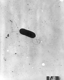 <em>Listeria monocytogenes</em> est un petit bacille péritriche (flagelles latéraux). Cette bactérie est responsable de la listériose, maladie infectieuse rare mais grave, notamment chez la femme enceinte. © Elizabeth White, Wikipedia Commons, Domaine public