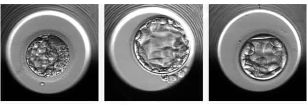 Exemple d'embryons évalués par Stork-A. Ceux de gauche et du milieu sont viables tandis que celui de droite présente une aneuploïdie. © Weill Cornell Medicine