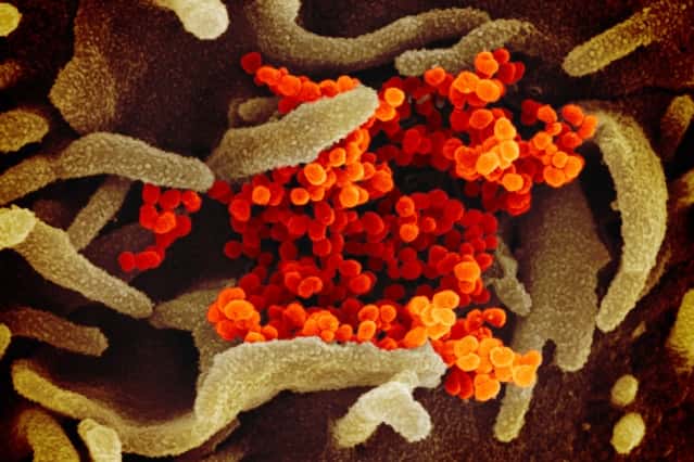 Une photo en microscopie électronique du SARS-CoV-2 (en orange) sur des cellules cultivées en laboratoire (vert). © NIAID, RML