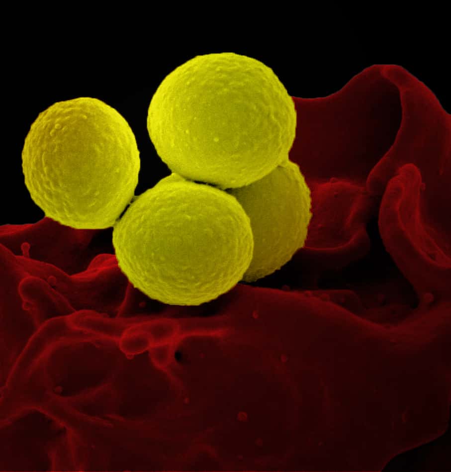Staphylocoque doré résistant à la méticilline (SARM, ou MRSA en anglais) vu au microscope électronique. © <em>National Institute of Allergy and Infectious Diseases</em> (NIAID), <em>Wikimedia Commons</em>, CC by 2.0