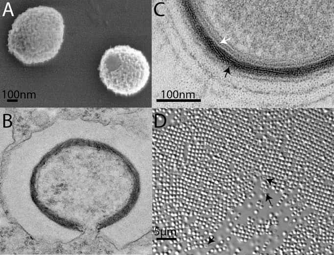 <em>Mollivirus sibericum</em> observé par l’Institut de Microbiologie de la Méditerranée. On le voit en microscopie électronique en A (le virion avec son enveloppe), en B (juste ingéré par l'amibe) et en C (avec une structure fibreuse, montrée par la flèche noire, une ressemblance avec Pandoravirus). En D, une image exceptionnelle : une multitude de virus vus en microscopie optique, avec un grossissement de 63 fois seulement. © Mathieu Legendre <em>et al.</em>, <em>Pnas</em>