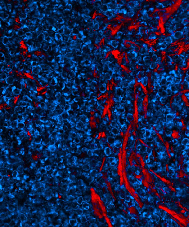 L'échafaudage formé par le vaccin (en rouge) a été infiltré par des cellules dendritiques et d'autres cellules immunitaires (en bleu). © Aileen Li