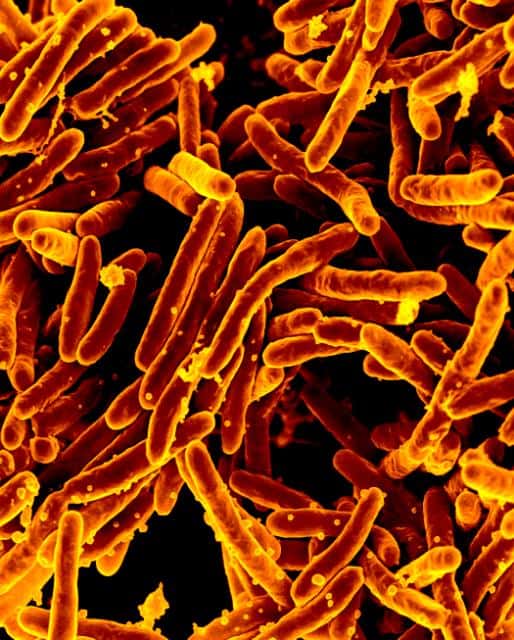 La bactérie <em>Mycobacterium tuberculosis</em>, agent de la tuberculose, pose parfois des problèmes de résistance aux antibiotiques, d’où la nécessité de trouver de nouveaux traitements. © NIAID, Flickr, DP
