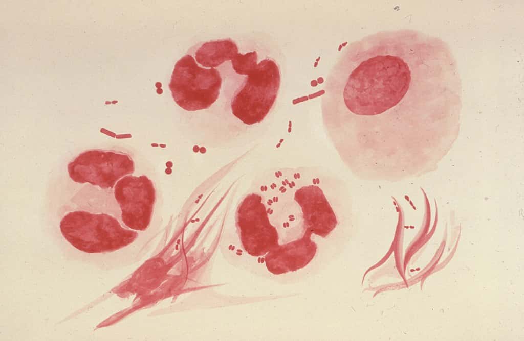 Des <em>Neisseria gonorrhoeae</em> infectant des neutrophiles (en bas au centre). On distingue bien leur forme particulière dite en « grain de café ». © CDC, Dr. Norman Jacobs