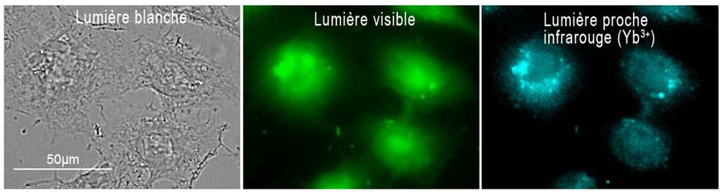Cellules « HeLa » (issues d’une lignée cancéreuse) ayant été incubées avec le nano-MOF-Yb-PVDC-3, un nouveau marqueur. L'imagerie proche infrarouge permet de localiser de façon plus précise le signal de fluorescence émis par ce nano-MOF (<em>metal-organic framework</em>) sans lumière parasite d'autofluorescence dans le visible. © CBM