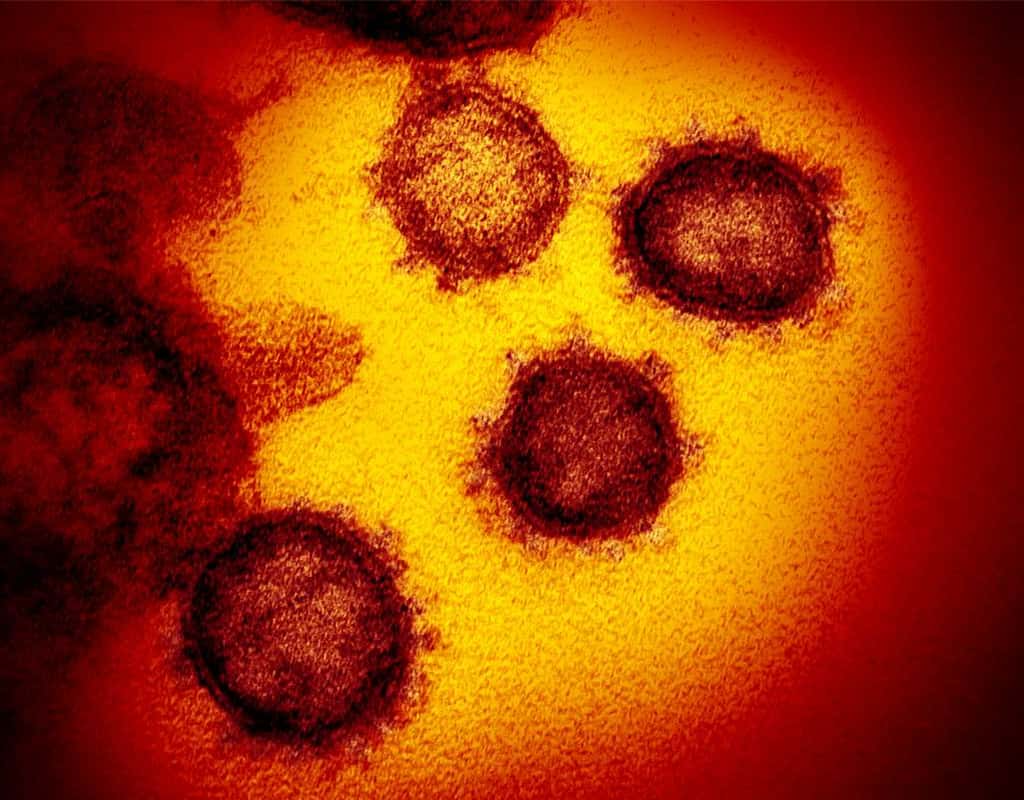 La dispersion du SARS-CoV-2 n'a rien à voir avec celle d'un virus de la grippe. © NIAID-RML, Adobe Stock