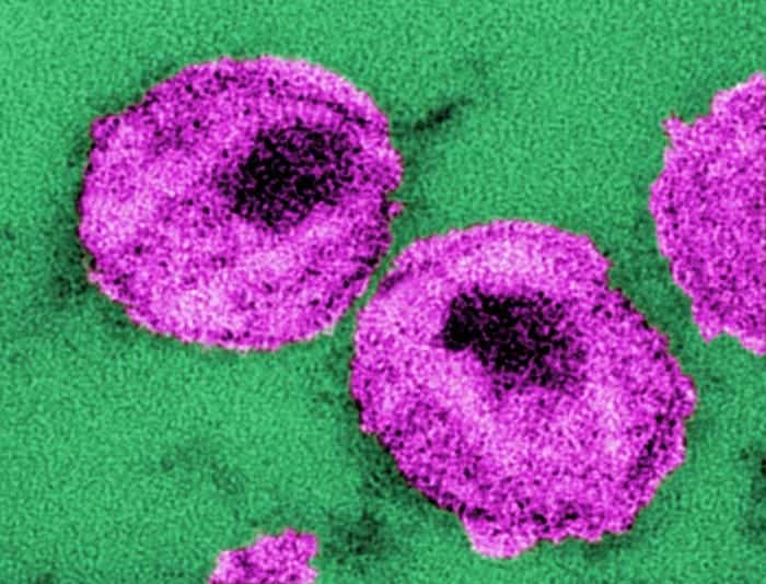 Le VIH, ici représenté en rose, appartient au genre des lentivirus, des virus qui ont pour particularité d’exiger une longue période d’incubation avant de révéler leur pouvoir pathogène. © A. Harrison, P. Feorino, CDC, DP