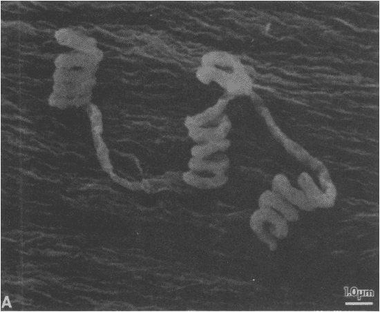  <em>Streptomyces avermitilis</em> : bactérie vivant dans le sol. © Hyun Tae-Woong, Wikimedia Commons, CC by-sa 4.0