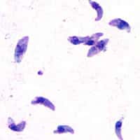 <em>Toxoplasma gondii</em> (coloration Giemsa) : à partir d'un frottis de liquide péritonéal de souris infectée. © DPDX Image library, Wikimedia Commons, domaine public