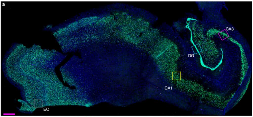 Les neurones immatures se forment dans le gyrus denté (noté ici DG), une région de l’hippocampe, la partie du cerveau impliquée dans l’apprentissage, la mémoire et les émotions. <i>© Elena P. Moreno-Jiménez et al, Nature Medicine, 2019</i>