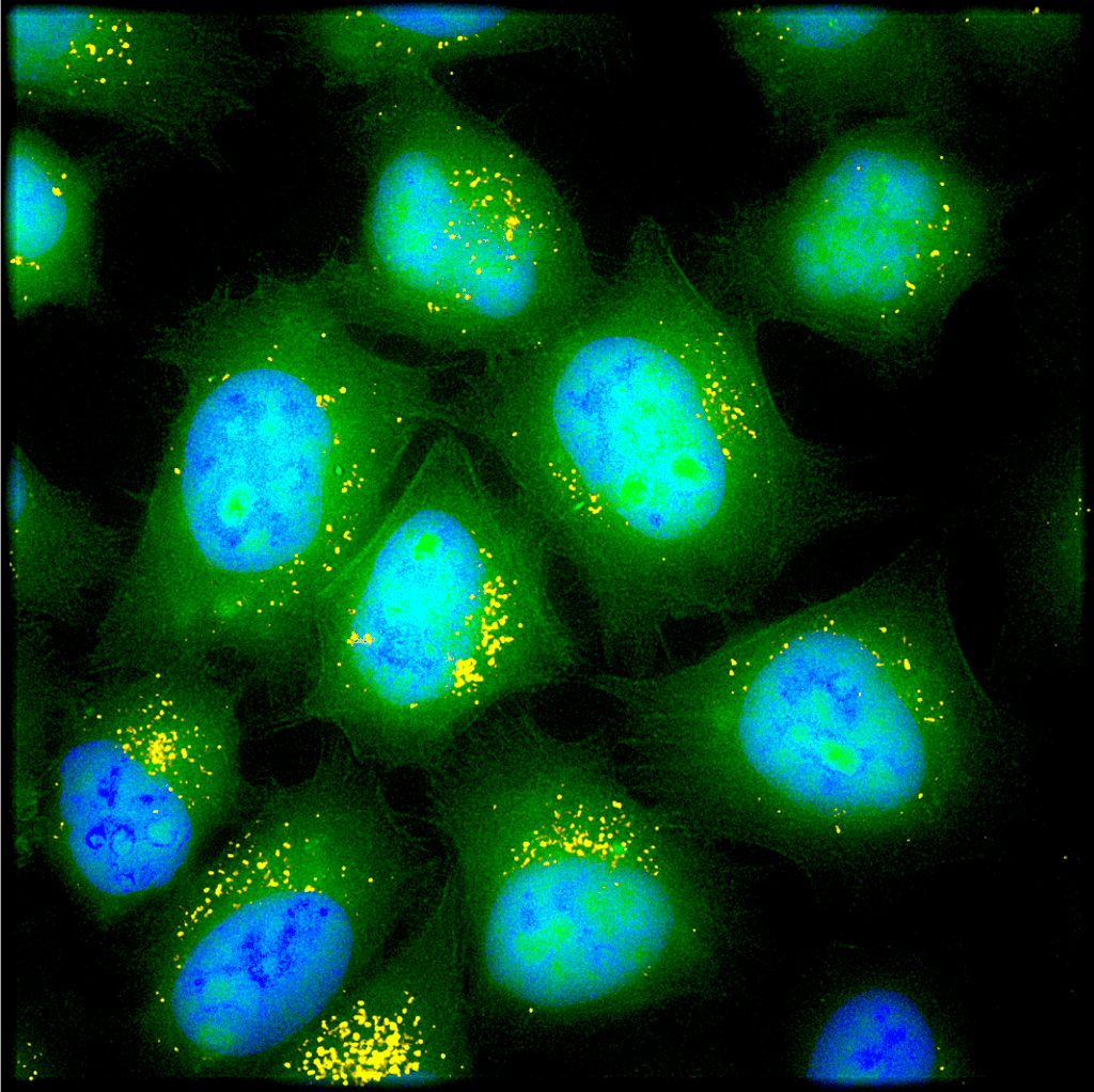 Les cellules pulmonaires épithéliales captent les microspores contenant l’ARNm codant pour la luciférase (en jaune). © Asha Patel, MIT