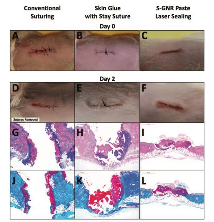 Grâce à l’activation du biopolymère par laser, la cicatrisation est plus rapide et plus profonde qu’avec une suture conventionnelle (A) ou une biocolle classique sans laser (B). © Russell Urie et al,<i> Advanced Functional Materials</i>