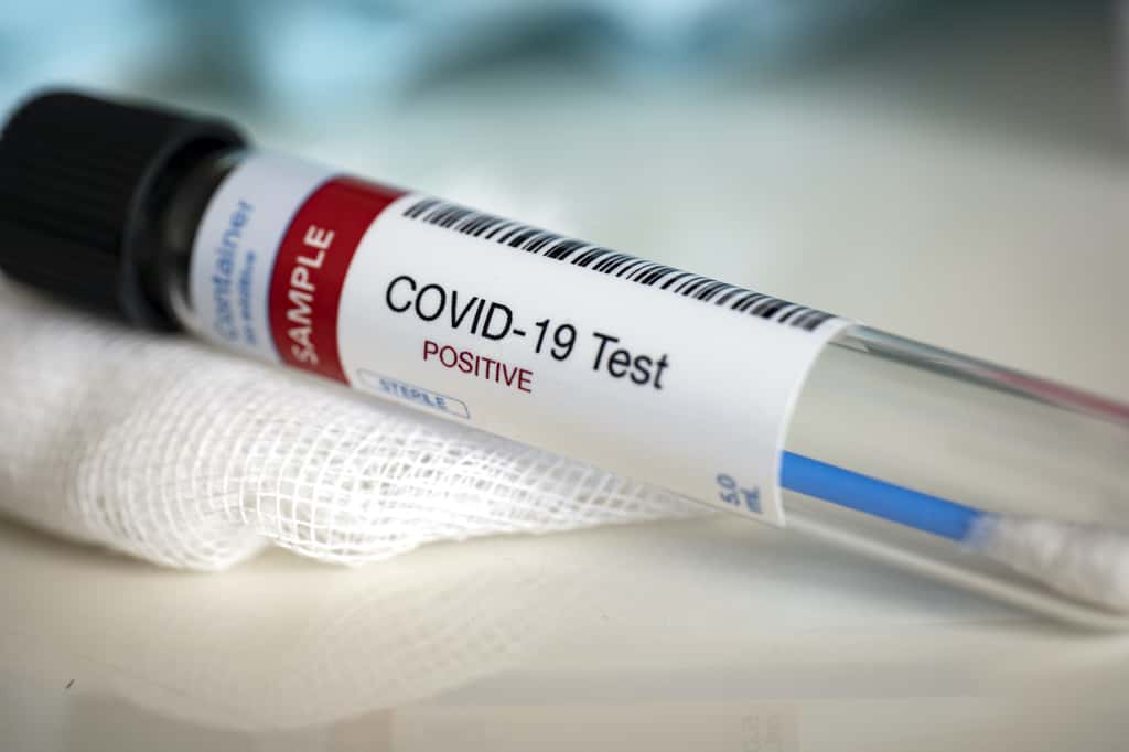 Test positif au coronavirus signifie-t-il personne contagieuse ? © MyriamB, Adobe Stock