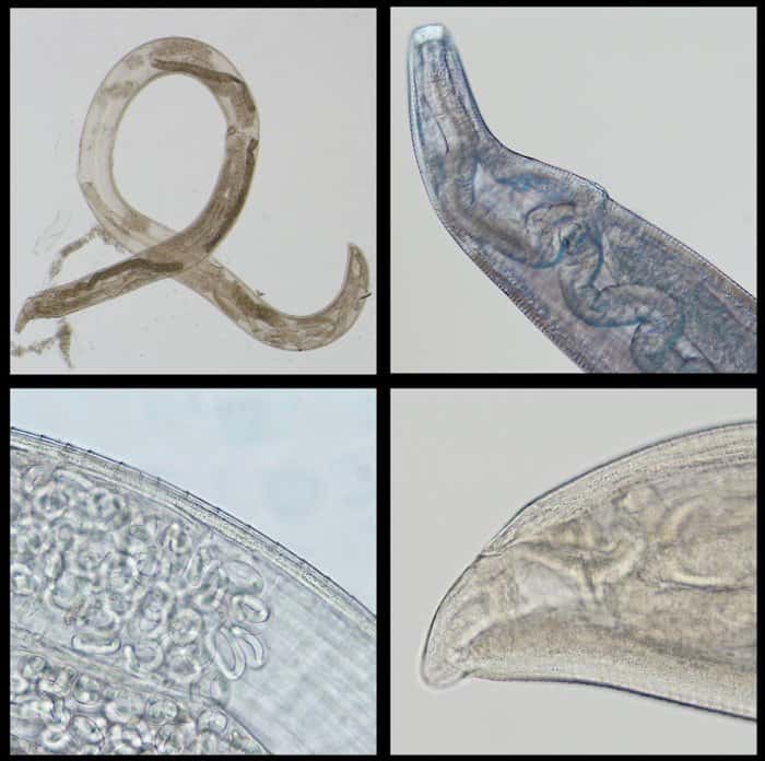 Le ver <em>T.gulosa</em> (en haut à gauche) et les ovaires contenant les œufs que la femelle peut pondre dans l’œil. À droite, les cavités anales et buccales. © Richard S. Bradbury et al., <em>Clinical Infectious Diseases</em>, 2019