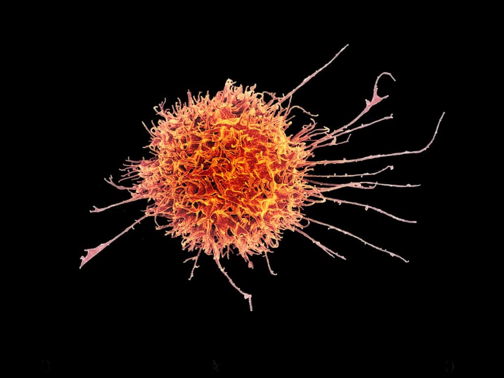 Les cellules dendritiques activent le système immunitaire adaptatif en produisant et en présentant l'antigène aux lymphocytes T. © <em>National Institute of Allergy and Infectious Diseases</em>, NIH