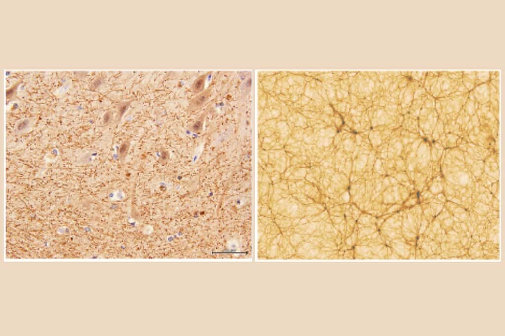 À gauche, une section du cervelet grossie 40x. À droite, une simulation cosmologique de l’Univers (portion de 300 millions d’années). © Université de Bologne
