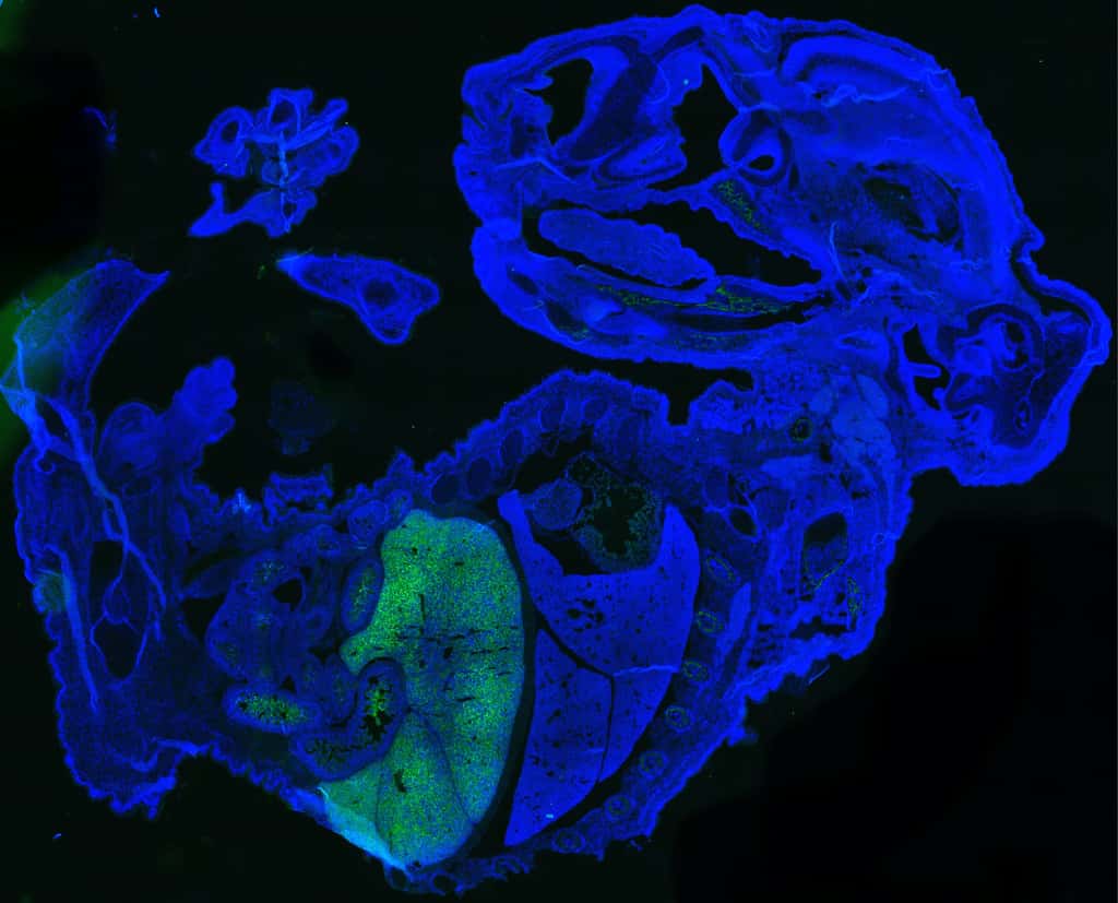 Cette image montre une grande quantité de cellules humaines (en vert) dans un embryon de souris de 17 jours (en bleu). La plupart des cellules humaines sont des globules rouges, qui s'accumulent dans le foie fœtal de la souris. © Zhixing Hu, Université de Buffalo
