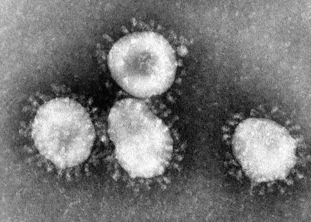 Le virus incriminé pourrait être de la famille coronavirus, qui inclut le SRAS et le rhume. © <em>US Center for Disease Control and Prevention</em> 